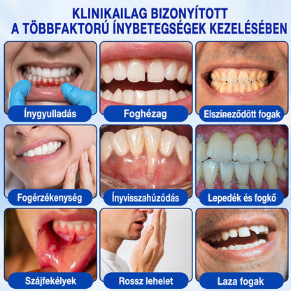 CleraNaure®💎 GumRevive – fejlett gél az íny és a fogágy ápolására🇭🇺👨‍⚕️