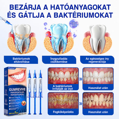 CleraNaure®💎 GumRevive – fejlett gél az íny és a fogágy ápolására🇭🇺👨‍⚕️