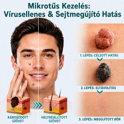🎉🇭🇺 Healrize® 2 az 1-ben mikrotűs + hidrokolloid tapasz 🤩| Anyajegy, pattanás, lapos szemölcs és bőrkinövés ápolására | Ráncok, hegek és bőrhibák megjelenésének javítására | Láthatatlan tapasz arcra és testre