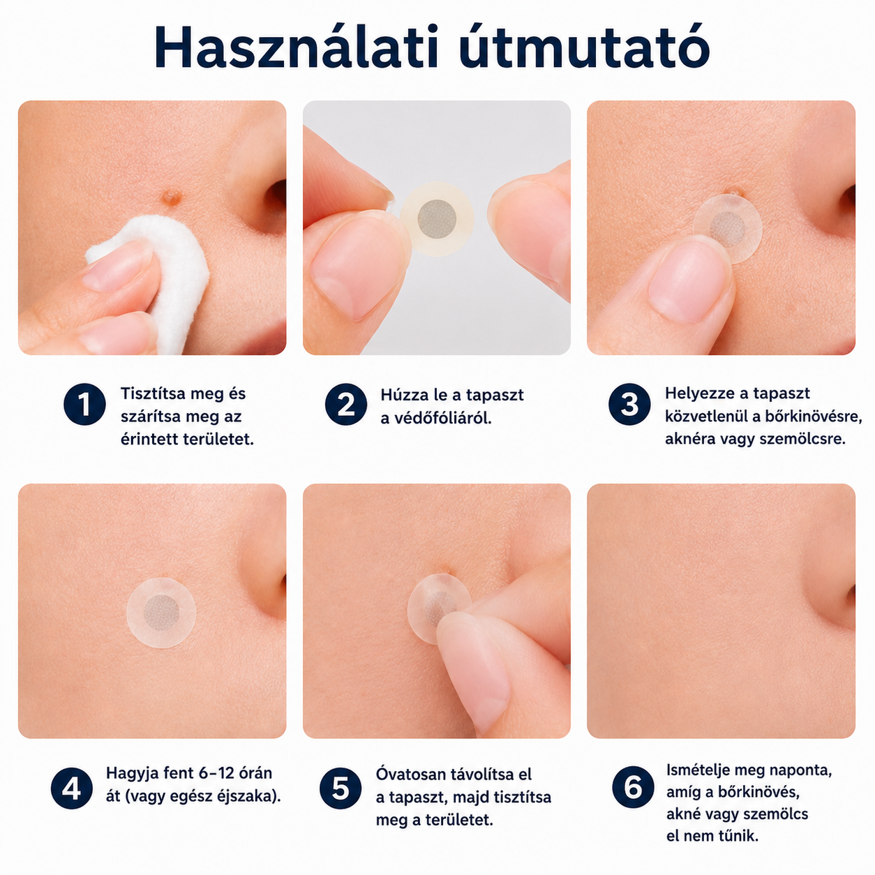 🎉🇭🇺 Healrize® 2 az 1-ben mikrotűs + hidrokolloid tapasz 🤩| Anyajegy, pattanás, lapos szemölcs és bőrkinövés ápolására | Ráncok, hegek és bőrhibák megjelenésének javítására | Láthatatlan tapasz arcra és testre