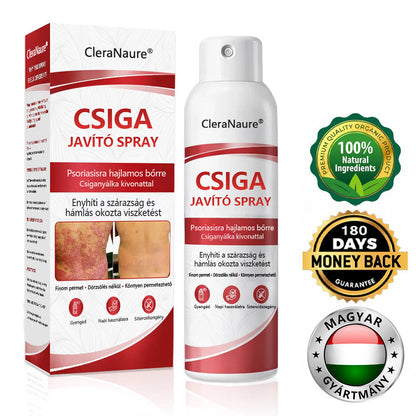 CleraNature® Bálnazsír Spray Viszkető, Hámló Psoriasisra Hajlamos Bőrre⭐⭐