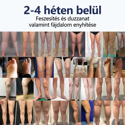 Buzora® keringést támogató krém duzzadt, nehéz lábakra🎁