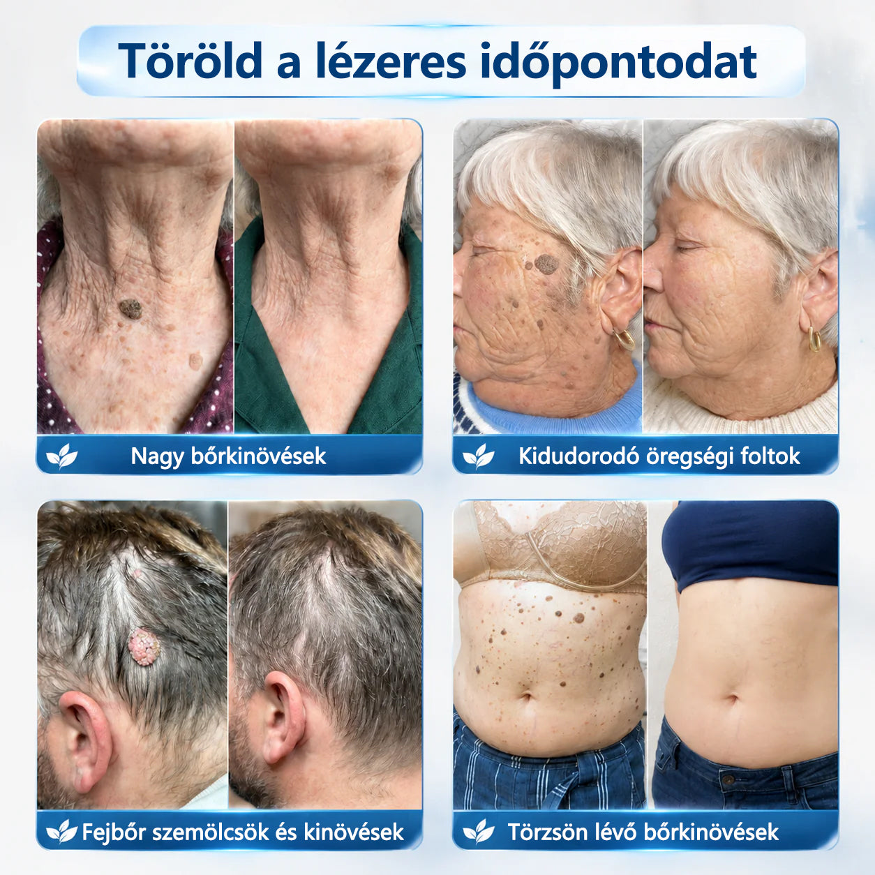 🛡️Hivatalos áruház🎉CleraNaure® 7 napos pigmentfolt- és bőrhiba-eltüntető kezelés (Fájdalommentes, hegmentes görgős applikátor)🛡️🛡️