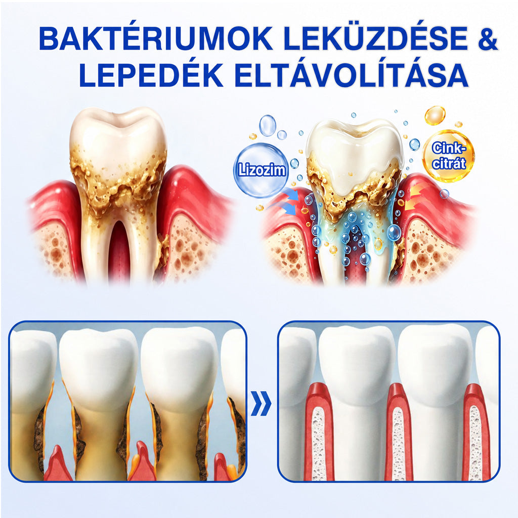 CleraNaure®💎 GumRevive – fejlett gél az íny és a fogágy ápolására🇭🇺👨‍⚕️