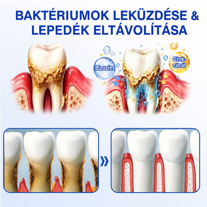 CleraNaure®💎 GumRevive – fejlett gél az íny és a fogágy ápolására🇭🇺👨‍⚕️