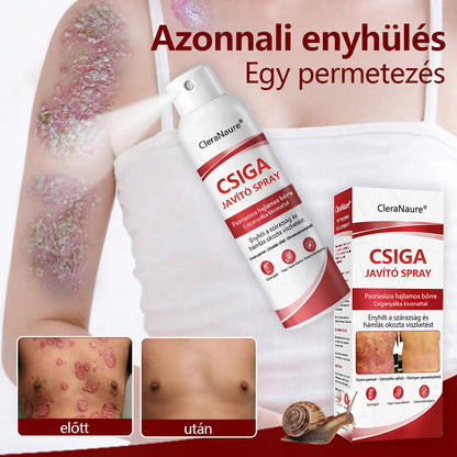 CleraNature® Bálnazsír Spray Viszkető, Hámló Psoriasisra Hajlamos Bőrre⭐⭐