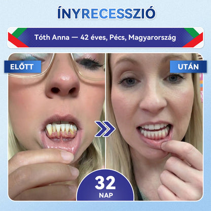 🦷🦷CleraNaure® Tideglusib Fog & íny Javító mikrotűs tapasz | Fejlett őssejt-aktiváló fogcsíkok (újjáépíti a fogzománcot és a dentint • erősíti az ínyt • megszünteti a fogkövet és a szagokat • megállítja a fogérzékenységet)3.0🦷