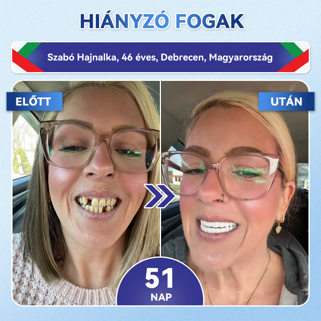 🦷🦷CleraNaure® Tideglusib Fog & íny Javító mikrotűs tapasz | Fejlett őssejt-aktiváló fogcsíkok (újjáépíti a fogzománcot és a dentint • erősíti az ínyt • megszünteti a fogkövet és a szagokat • megállítja a fogérzékenységet)3.0🦷