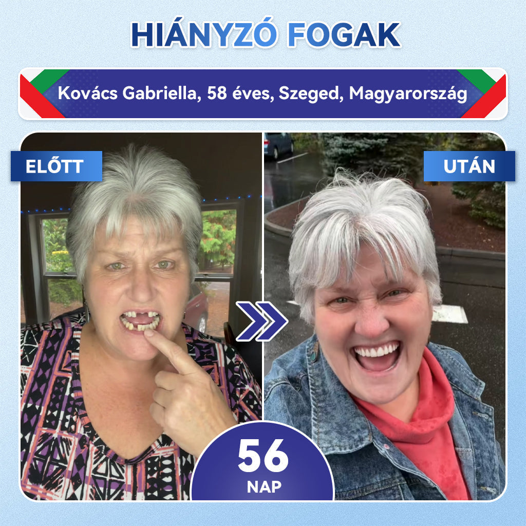 🦷🦷CleraNaure® Tideglusib Fog & íny Javító mikrotűs tapasz | Fejlett őssejt-aktiváló fogcsíkok (újjáépíti a fogzománcot és a dentint • erősíti az ínyt • megszünteti a fogkövet és a szagokat • megállítja a fogérzékenységet)3.0🦷