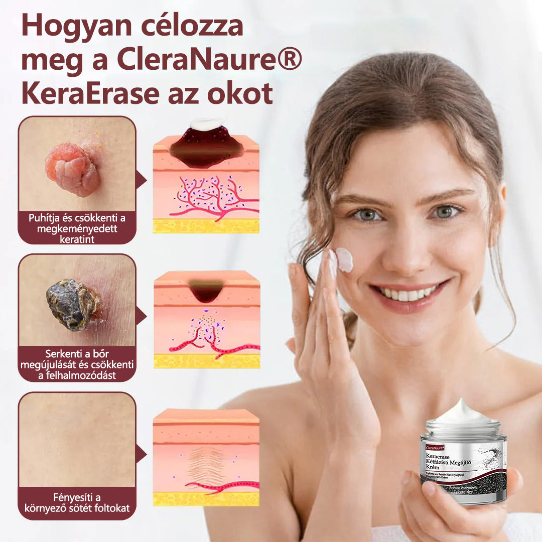 🧡Hivatalos áruház👨‍⚕️ CleraNaure® KeraErase - Kettős hatású bőrfiatalító krém 👨‍⚕️ (Kettős hatású fiatalítás – simítja a kiemelkedő dudorokat és lebontja a mélyen lerakódott keratint savak és irritáció nélkül)🌙🌙