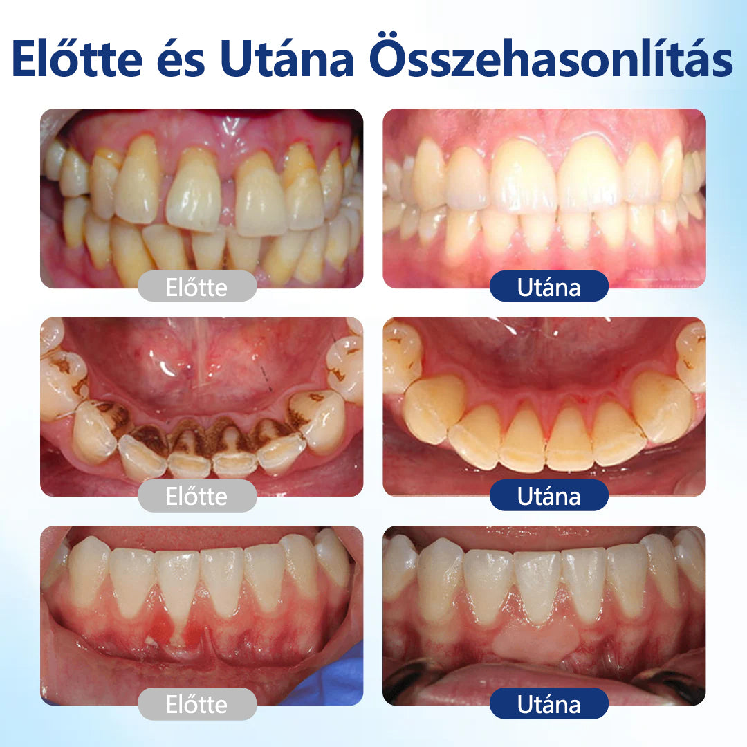 💎CleraNaure® BeeTakt Szájápoló Javító Oldat ✨