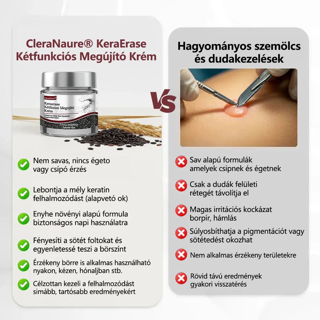🧡Hivatalos áruház👨‍⚕️ CleraNaure® KeraErase - Kettős hatású bőrfiatalító krém 👨‍⚕️ (Kettős hatású fiatalítás – simítja a kiemelkedő dudorokat és lebontja a mélyen lerakódott keratint savak és irritáció nélkül)🌙🌙