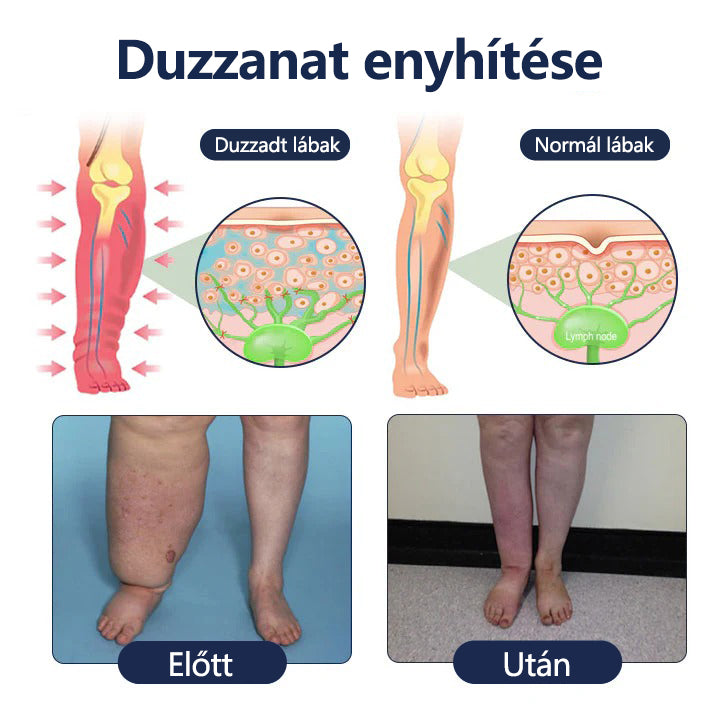 Buzora® keringést támogató krém duzzadt, nehéz lábakra