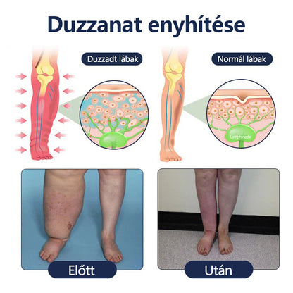 Buzora® keringést támogató krém duzzadt, nehéz lábakra🎁