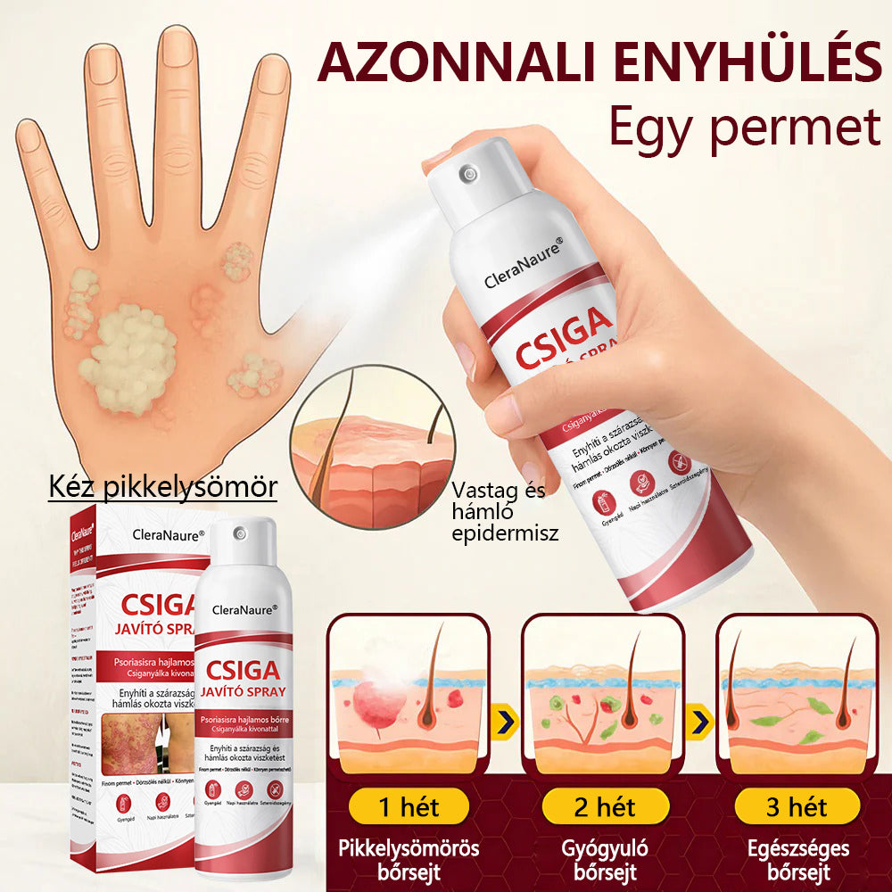 CleraNature® Bálnazsír Spray Viszkető, Hámló Psoriasisra Hajlamos Bőrre⭐⭐