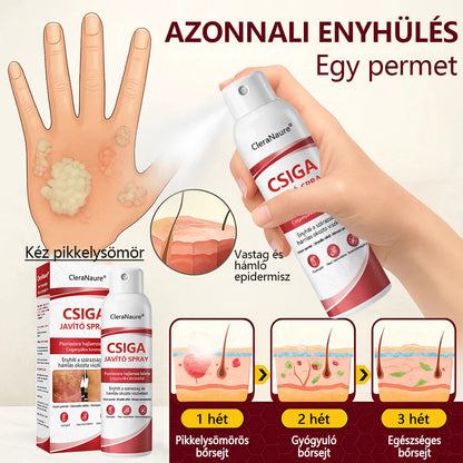 CleraNature® Bálnazsír Spray Viszkető, Hámló Psoriasisra Hajlamos Bőrre⭐⭐