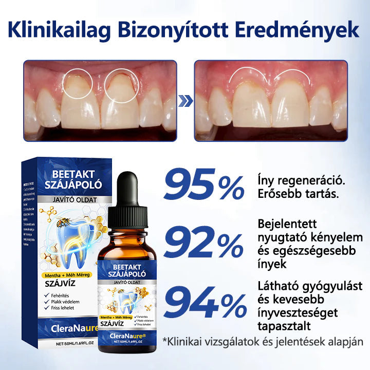 💎CleraNaure® BeeTakt Szájápoló Javító Oldat ✨