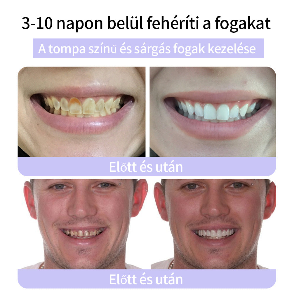 🦷🦷CleraNature® Fogak Helyreállító Ásványi Por