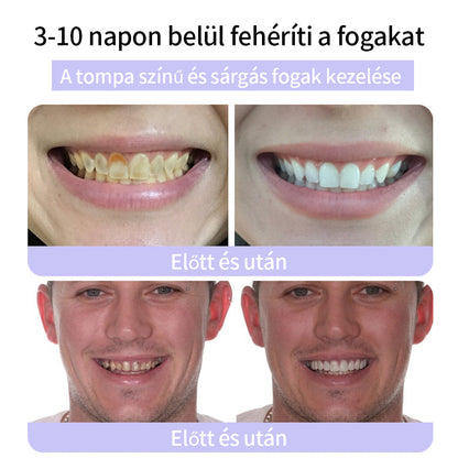 🦷🦷CleraNature® Fogak Helyreállító Ásványi Por