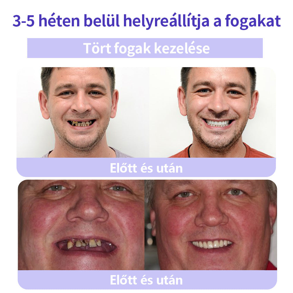 🦷🦷CleraNature® Fogak Helyreállító Ásványi Por