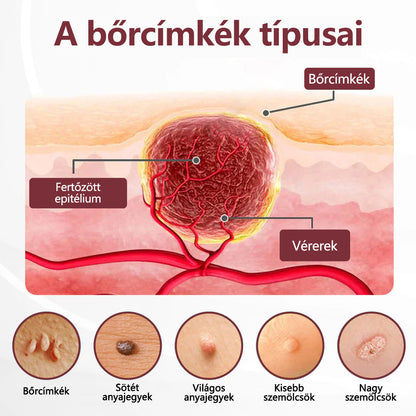 🧡Hivatalos áruház👨‍⚕️ CleraNaure® KeraErase - Kettős hatású bőrfiatalító krém 👨‍⚕️ (Kettős hatású fiatalítás – simítja a kiemelkedő dudorokat és lebontja a mélyen lerakódott keratint savak és irritáció nélkül)🌙🌙