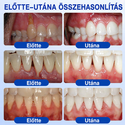CleraNaure®💎 GumRevive – fejlett gél az íny és a fogágy ápolására🇭🇺👨‍⚕️