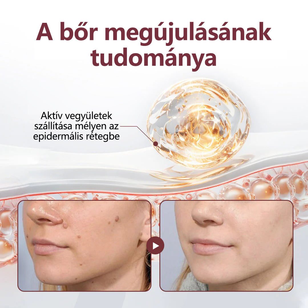 🧡Hivatalos áruház👨‍⚕️ CleraNaure® KeraErase - Kettős hatású bőrfiatalító krém 👨‍⚕️ (Kettős hatású fiatalítás – simítja a kiemelkedő dudorokat és lebontja a mélyen lerakódott keratint savak és irritáció nélkül)🌙🌙